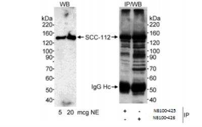 Immunoprecipitation: SCC112 Antibody [NB100-425]