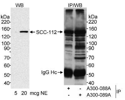 Western Blot: SCC112 Antibody [NB100-426]