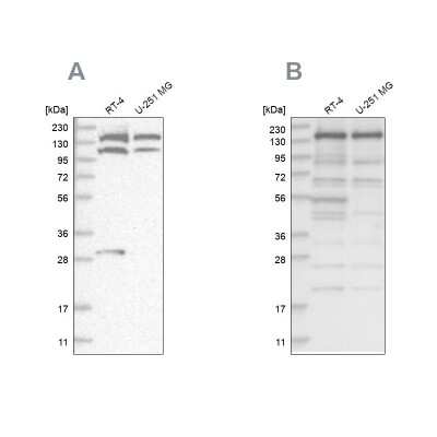 Western Blot: SCC112 Antibody [NBP2-38313]