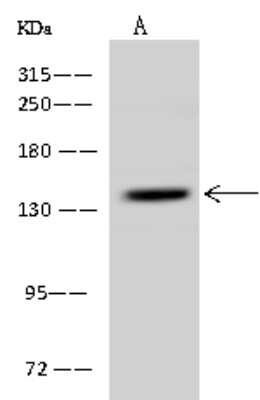 Western Blot: SCC112 Antibody [NBP2-98627]