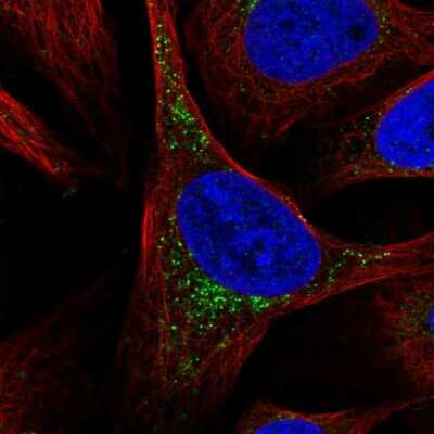 Immunocytochemistry/ Immunofluorescence: SCCPDH Antibody [NBP2-13287]