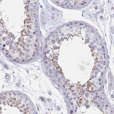 Immunohistochemistry-Paraffin: SCCPDH Antibody [NBP2-13287]