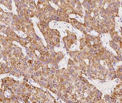 Immunohistochemistry-Paraffin: SCCPDH Antibody [NBP2-97630]