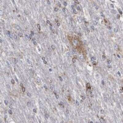 Immunohistochemistry-Paraffin: SCCPDH Antibody [NBP3-17042]