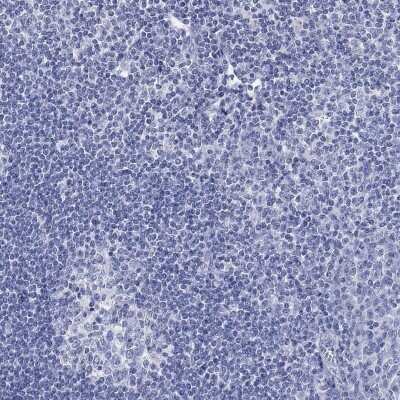 Immunohistochemistry-Paraffin: SCCPDH Antibody [NBP3-17042]
