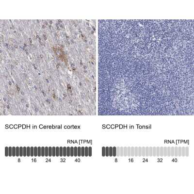 Immunohistochemistry-Paraffin: SCCPDH Antibody [NBP3-17042]