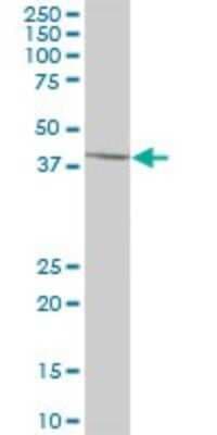 Western Blot: SCCPDH Antibody [H00051097-B01P]