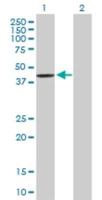 Western Blot: SCCPDH Antibody [H00051097-B01P]