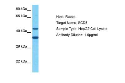 Western Blot: SCD5 Antibody [NBP2-83498]
