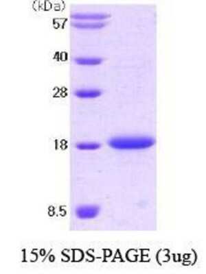 SDS-PAGE: Recombinant Mouse SCF/c-kit Ligand Protein [NBC1-18486]