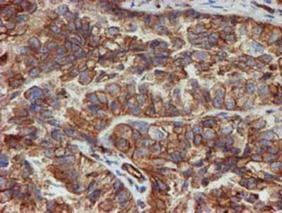 Immunohistochemistry: SCFD1 Antibody (OTI5G4) - Azide and BSA Free [NBP2-74004]