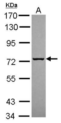 Western Blot: SCFD1 Antibody [NBP2-20268]