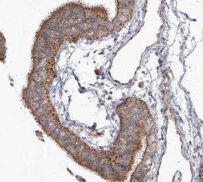 Immunohistochemistry-Paraffin: SCGB1D2 Antibody [NBP1-81304]
