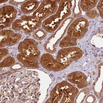 Immunohistochemistry-Paraffin: SCGBL Antibody [NBP1-92367]