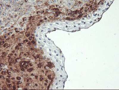 Immunohistochemistry-Paraffin: SCHIP1 Antibody (OTI1C8) [NBP2-01872]