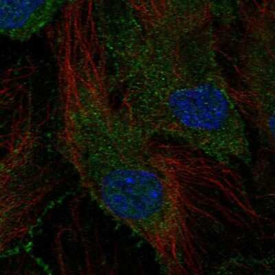 Immunocytochemistry/ Immunofluorescence: SCHIP1 Antibody [NBP2-68891]
