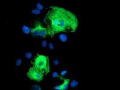Immunocytochemistry/ Immunofluorescence: SCHIP1 Antibody (OTI1C8) - Azide and BSA Free [NBP2-74008]