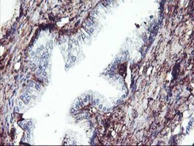 Immunohistochemistry: SCHIP1 Antibody (OTI1C8) - Azide and BSA Free [NBP2-74008]