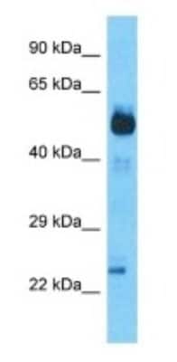 Western Blot: SCHIP1 Antibody [NBP3-09332]