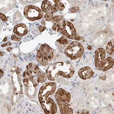 Immunohistochemistry-Paraffin: SCIN Antibody [NBP1-89229]