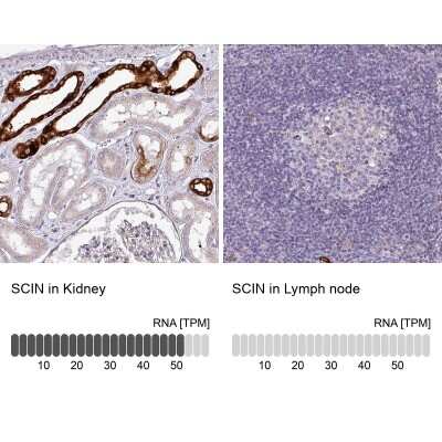 Immunohistochemistry-Paraffin: SCIN Antibody [NBP1-89230]