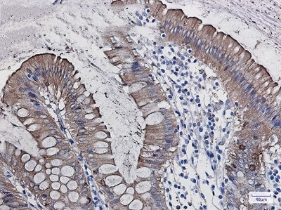 Immunohistochemistry-Paraffin: SCIN Antibody (S07-6G2) [NBP3-19768]