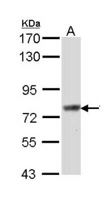 Western Blot: SCIN Antibody [NBP1-31721]