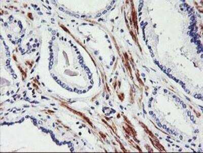 Immunohistochemistry-Paraffin: SCL/Tal1 Antibody (OTI5H1) [NBP2-01488]