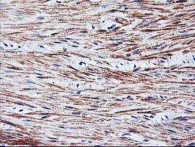 Immunohistochemistry-Paraffin: SCL/Tal1 Antibody (OTI5H1) [NBP2-01488]