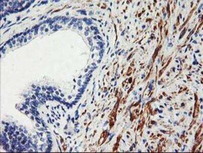 Immunohistochemistry-Paraffin: SCL/Tal1 Antibody (OTI5H1) [NBP2-01488]