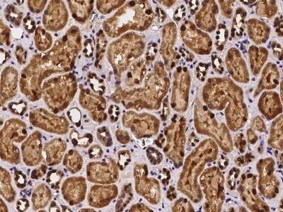 Immunohistochemistry-Paraffin: SCLY Antibody [NBP2-97263]
