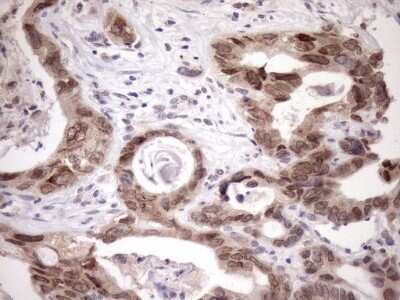 Immunohistochemistry: SCMH1 Antibody (OTI5E6) [NBP2-45724]