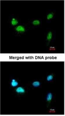 Immunocytochemistry/ Immunofluorescence: SCMH1 Antibody [NBP1-32517]