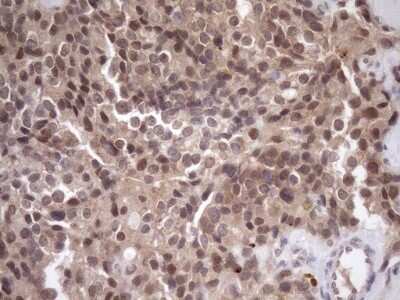 Immunohistochemistry: SCMH1 Antibody (OTI5E6) - Azide and BSA Free [NBP2-74023]