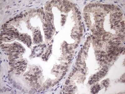 Immunohistochemistry: SCMH1 Antibody (OTI5E6) - Azide and BSA Free [NBP2-74023]