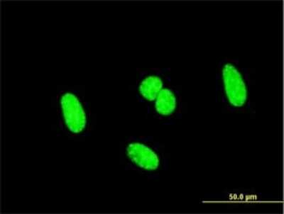 Immunocytochemistry/ Immunofluorescence: SCML1 Antibody (4G3) [H00006322-M01]