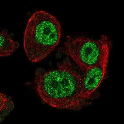 Immunocytochemistry/ Immunofluorescence: SCML1 Antibody [NBP2-55711]