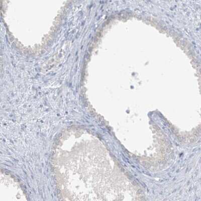 Immunohistochemistry-Paraffin: SCML1 Antibody [NBP1-85909]