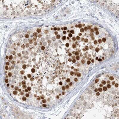 Immunohistochemistry-Paraffin: SCML1 Antibody [NBP1-85909]