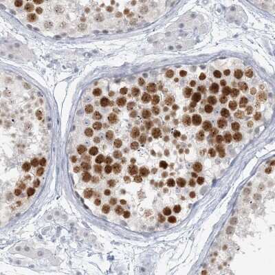 Immunohistochemistry-Paraffin: SCML1 Antibody [NBP1-86309]