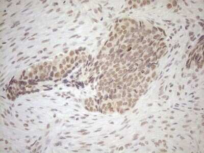 Immunohistochemistry: SCML2 Antibody (OTI1E1) [NBP2-45725]
