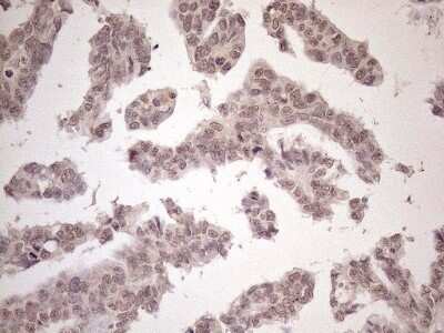 Immunohistochemistry: SCML2 Antibody (OTI1E1) - Azide and BSA Free [NBP2-74024]