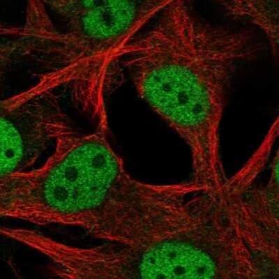 Immunocytochemistry/ Immunofluorescence: SCML4 Antibody [NBP2-56528]
