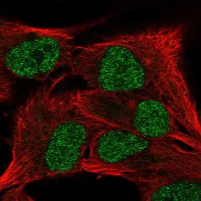 Immunocytochemistry/ Immunofluorescence: SCML4 Antibody [NBP2-57381]
