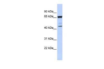Western Blot: SCML4 Antibody [NBP2-88220]