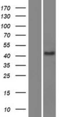 Western Blot: SCML4 Overexpression Lysate [NBP2-04644]