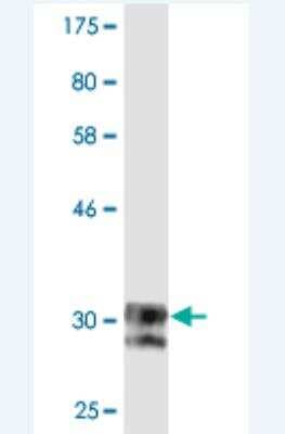 Western Blot: SCN11A Antibody (2B10) [H00011280-M02]