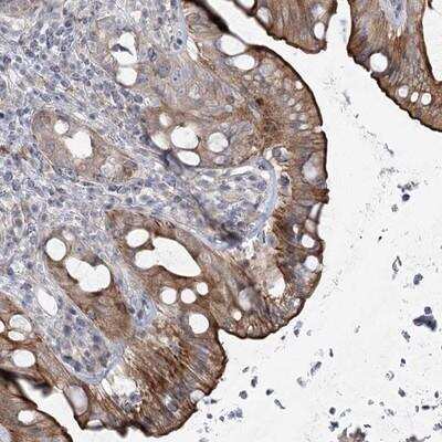 Immunohistochemistry-Paraffin: SCN11A Antibody [NBP1-82600]
