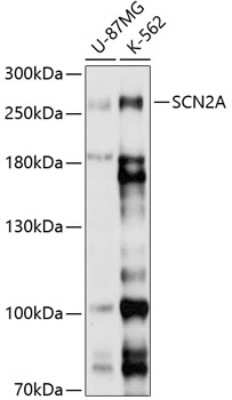 Western Blot: SCN2A AntibodyAzide and BSA Free [NBP2-93246]