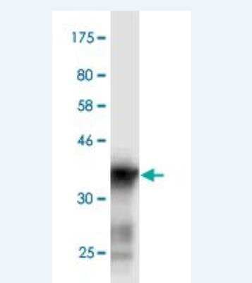 Western Blot: SCN3A Antibody (2F8) [H00006328-M06]